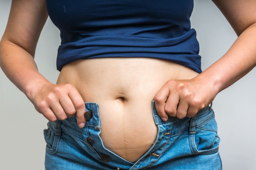 Übergewicht durch Vitamin-D-Mangel